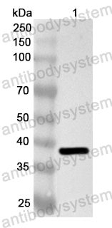 Anti-Human ZSCAN12 Polyclonal Antibody