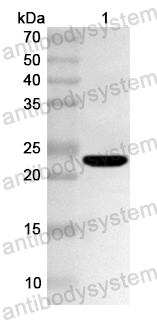 Anti-Human TBX1 Polyclonal Antibody