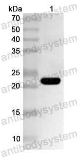 Anti-Human PPIH Polyclonal Antibody