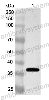 Anti-Human AKR7A2 Polyclonal Antibody
