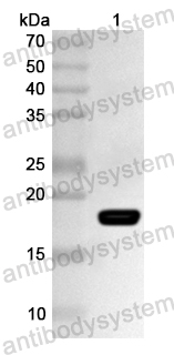 Anti-Human RNF13 Polyclonal Antibody