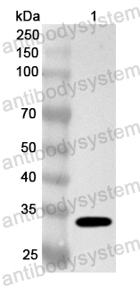 Anti-Human SYT7 Polyclonal Antibody