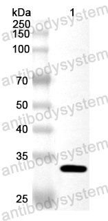 Anti-Human PSTPIP1 Polyclonal Antibody