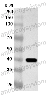 Anti-Human GALR2 Polyclonal Antibody