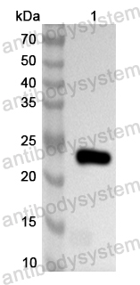 Anti-Human NCK2 Polyclonal Antibody
