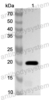 Anti-Human RGS10 Polyclonal Antibody