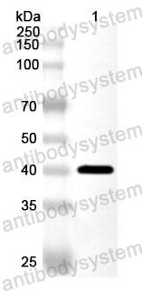 Anti-Human NDUFB5 Polyclonal Antibody