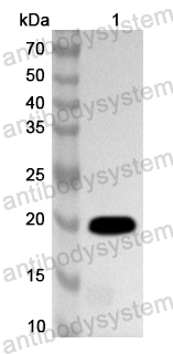 Anti-Human LDB2 Polyclonal Antibody