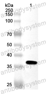 Anti-Human SULT1B1 Polyclonal Antibody