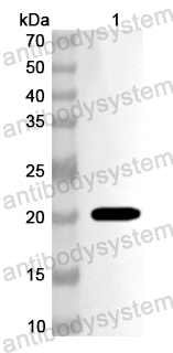Anti-Human TRAF3IP2 Polyclonal Antibody