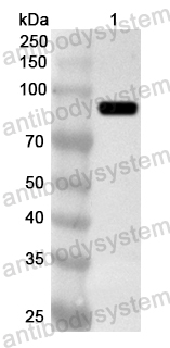 Anti-Human AKAP8 Polyclonal Antibody