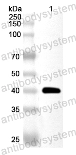 Anti-Human IDH3B Polyclonal Antibody