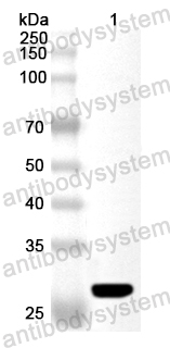 Anti-Human ADCY3 Polyclonal Antibody