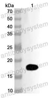Anti-Human NOBOX Polyclonal Antibody