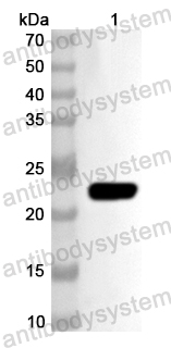 Anti-Human ZIC3 Polyclonal Antibody