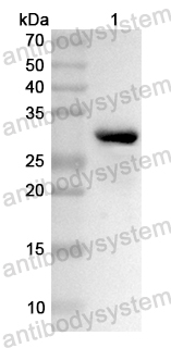 Anti-Human DOK2 Polyclonal Antibody