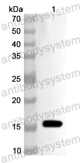 Anti-Human CREBL2 Polyclonal Antibody