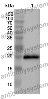 Anti-GREM1 Polyclonal Antibody