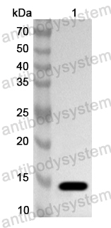 Anti-Human TSPAN1 Polyclonal Antibody