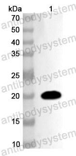 Anti-Human SNX2 Polyclonal Antibody