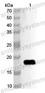 Anti-Human TOM1 Polyclonal Antibody