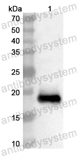 Anti-Human TRIM13 Polyclonal Antibody