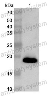 Anti-Human KIN Polyclonal Antibody