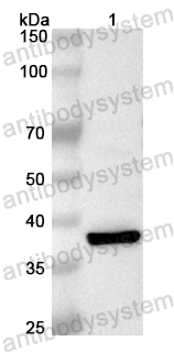 Anti-Human SH2D1A Polyclonal Antibody