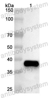 Anti-Human RAMP1 Polyclonal Antibody
