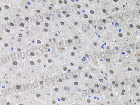 Immunohistochemical for Anti-Human HUS1 Polyclonal Antibody ?>