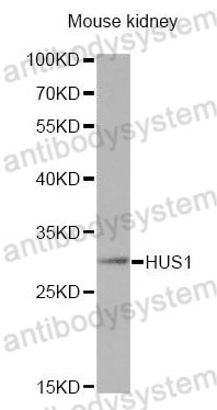 Western Blot for Anti-Human HUS1 Polyclonal Antibody ?>