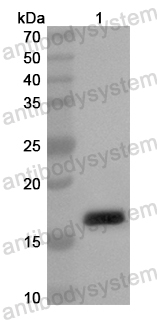 Anti-Human SCN2B Polyclonal Antibody