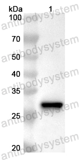 Anti-Human RNGTT Polyclonal Antibody