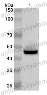 Anti-Human ADAM23 Polyclonal Antibody