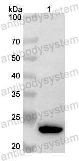 Anti-Human N4BP1 Polyclonal Antibody