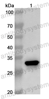 Anti-Human RNF40 Polyclonal Antibody