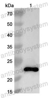 Anti-Human GGCT Polyclonal Antibody