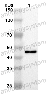 Anti-Human ENTPD5 Polyclonal Antibody