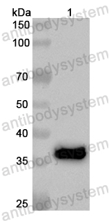 Anti-Human PROP1 Polyclonal Antibody