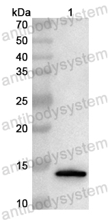 Anti-Human SH3BGRL Polyclonal Antibody