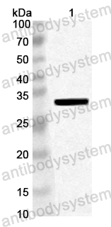 Anti-Human ULK1 Polyclonal Antibody