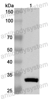 Anti-Human MTX2 Polyclonal Antibody