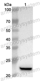 Anti-Human E2F6 Polyclonal Antibody