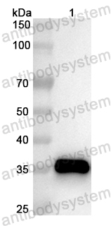Anti-Human CRLF1 Polyclonal Antibody