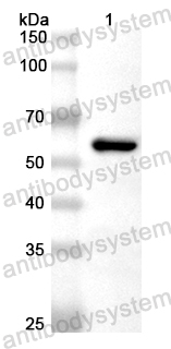 Anti-Human TADA2A Polyclonal Antibody
