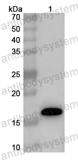 Anti-Human SRSF10 Polyclonal Antibody