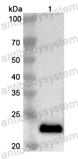 Anti-Human TADA3 Polyclonal Antibody