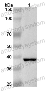Anti-Human TAF5L Polyclonal Antibody