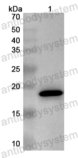 Anti-Human MED6 Polyclonal Antibody