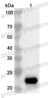 Anti-Human GCM2 Polyclonal Antibody